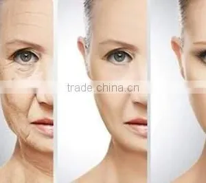 Portable American Ultrasonic Hifu Skin Care Skin Rejuvenation SMAS Hifu Machine/ SMAS Treatment HIFU thumbnail-6