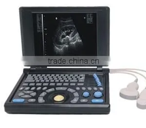 Big Sale PC Platform 10.4 Inch Laptop Ultrasound Scanner With 3.5Mhz Convex Probe CE ISO Certified thumbnail-5