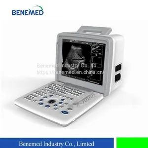 Portable B/W Ultrasound Scanner With Clear Image Quality thumbnail-1