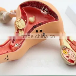 Human Uterus and Ovary Vaginal Pathological Changes Model of Reproductive Department of Gynecology Medical Demonstration Model thumbnail-1