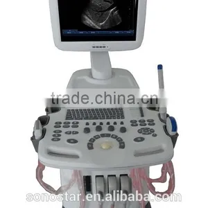 SS-600 Trolley Ultrasound Scanner thumbnail-3
