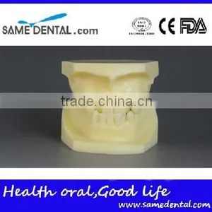 Malocclusion Classification Demonstration Model 2 thumbnail-2