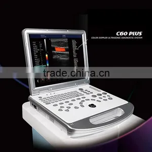 Ultrasound Machine ,ultrasound Machine Price,ultrasound Scanner thumbnail-1