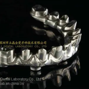 Full-arch Implant Bridge Prosthesis, Implant Denture Framework, Implant Prosthesis, Laboratoire Dentaire, Dentallabor, Laboratorio Dental, Dental Laboratory, Shenzhen LJ Dental Lab China thumbnail-1