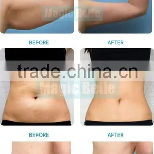 Fat Reduction Portable Cryolipolysis!!! RF/40K Cavitation/Laser Slimming Machine Cryolipolysis Device For Sale Fat Freezing thumbnail-6