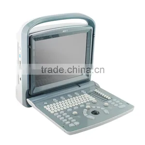 CE / ISO Certified Ultra Light Ultrasound Scanner With 2.5-5.0MHz Convex Probe High End Medical Equipment thumbnail-2