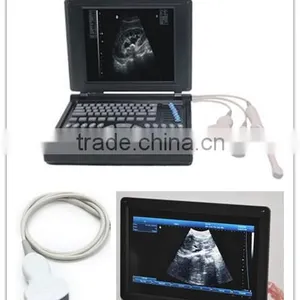 Hot Model Full Digital Laptop Type Ultrasound Scanner With Multi Probe Optional Printer thumbnail-1