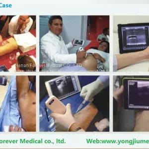 10MHz Apple Ios Android Wireless Ultrasound Probes Ultrasound Scanner thumbnail-4