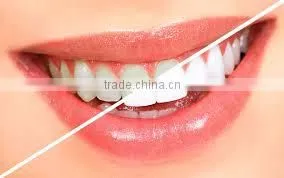 Teeth Cleaning and Whitening Gel,Innovating Products About Toothpaste,Personal Care,Dental Supply thumbnail-3