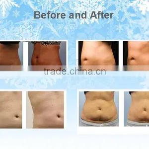 Slimming Reshaping 2016 Hot Selling Cryolipolysis Fat Freeze Slimming Machine For Weight Loss Salon Reduce Cellulite thumbnail-6