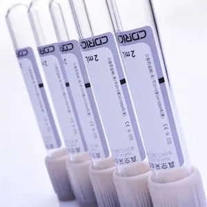 Oxalate Tube Plasma Tubes Evacuated Blood Collection Sodium Fluoride&Potassium Oxalate/EDTA K2 Tubes , Test Tube for Blood Sample Colletion (CE) thumbnail-1