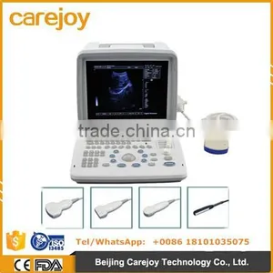 Portable Ultrasound Scanner With Convex Probe Transvaginal Micro-convex Rectal Probe Optional Video Printer thumbnail-1