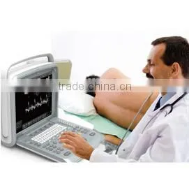 CE Approved Portable Color Ultrasound Scanner With Optional 4D Function( Q9) thumbnail-3