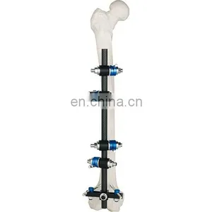 Orhtopedic External Fixator for Femur&Tibial thumbnail-1