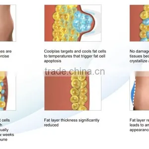 Cryo Machine Fat Freeze Slimming thumbnail-6