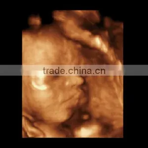 2016 New Portable Color Doppler(Optional 4D) for Cardiac Use thumbnail-6