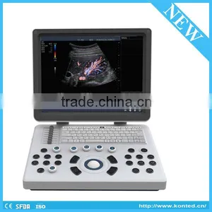 Portable Echography Machine/4D Laptop Ultrasound Scanner thumbnail-3