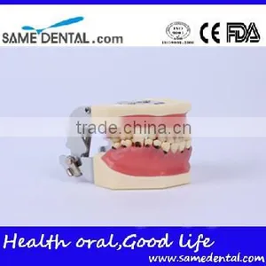 Dental Severe Periodontal Disease Model School Teaching thumbnail-1