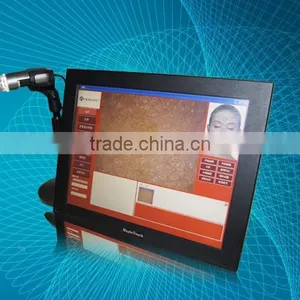 Companies Looking for Representative New Product Intelligent Skin Moisture Tester thumbnail-1