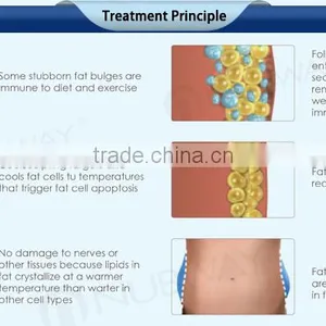 CE / FDA Approved 2 Cryo Handles Cellulite Lipo Slim Cellulite Reduction Fat Freezing Liposuction Machine thumbnail-5