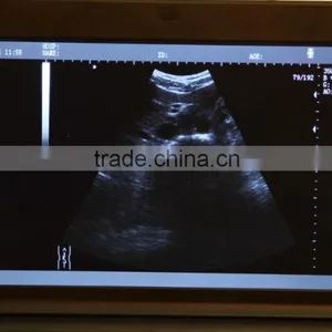 Hot Selling Cheap Price Full Digital Laptop Ultrasound Scanner RUS-9000F With 3.5Mhz Convex Probe Suitale for Emergency thumbnail-4