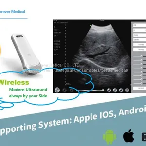 10MHz Apple Ios Android Wireless Ultrasound Probes Ultrasound Scanner thumbnail-3