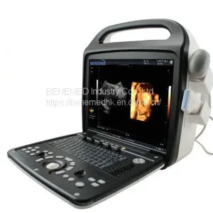 Premium 4D Color Doppler Ultrasound Scanner thumbnail-3