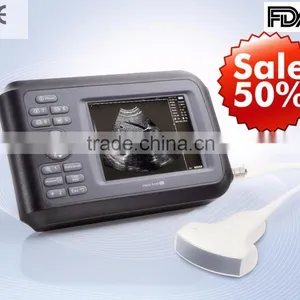 2015 New Handheld Ultrasound Scanner Palm Ultrasound Scanner Portable Ultrasound Scanner thumbnail-1