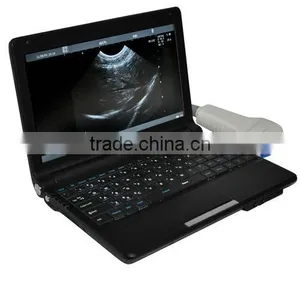 Cheap Price 10 Inch Laptop Ultrasound Scanner Convex Linear Micro-convex Rectal Transvaginal Probe thumbnail-2
