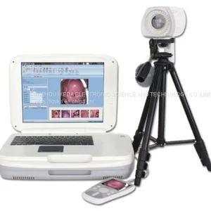 YKD-3004 Portable Digital Colposcope thumbnail-1