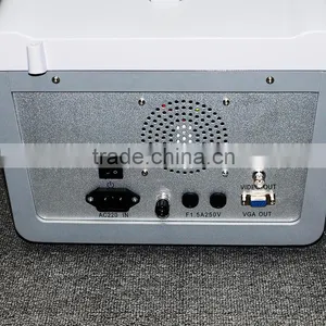 New Ultrasound Machine / Scanner Portable Ultrasonic Diagnostic System RUS-6000D With 3.5MHz Convex Probe Manufacturer thumbnail-5