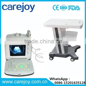 Digital Portable Ultrasound Scanner With Optional Trolley thumbnail-1