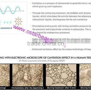 HOTSALE!! the Best Quality Home Cavitation Machine OB-C01 thumbnail-4