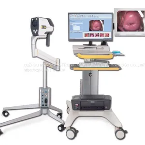 YKD-3002 HD Digital Electronic Colposcope thumbnail-1