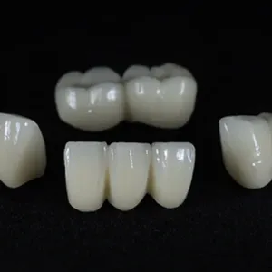 Dental Telescope Denture, Telesope Crown, Dental Prothesis, Laboratoire Dentaire, Dentallabor,Dental thumbnail-1