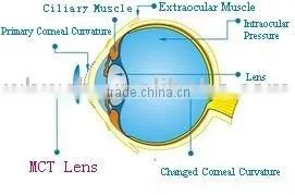 Medical Care Digital Professional Lens (MCT)/2013 thumbnail-1