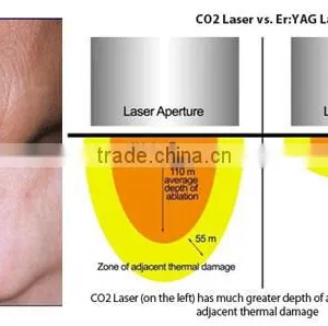 Medical Skin Tightening Fractional Co2 Laser Equipment Skin Treat Telangiectasis Age Spot Removal Rejuvenation Co2 Laser Scar Removal Acne Treatment Face Lifting thumbnail-5