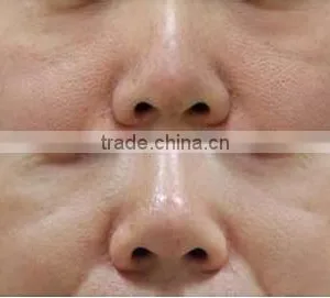 Professional PDT LED Light Facial Skin Rejuvenation Beauty Machine For Skin Rejuvenation Red Light Therapy For Wrinkles thumbnail-5