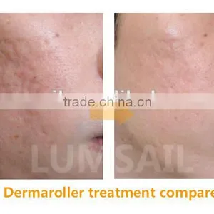 180 192 540 600 Needles Derma Roller Dermaroller Manufacturer thumbnail-4
