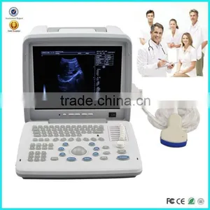 2016 Cheapest Portable Ultrasounic Diagnosis Scanner Machine System With Convex/ Linear Phased Array Transducer and Sony Printer thumbnail-1
