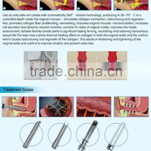 Professional CE Approval CO2 Fractional RF Laser Vaginal Tightening Machine thumbnail-6
