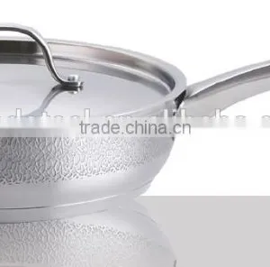 8pcs Cookware Set With Electro Corrosion on Exterior MSF-3635 thumbnail-4