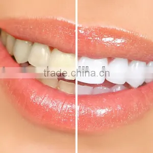 The Magic Tooth Whitening Pen thumbnail-1