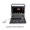 pc Based Ultrasound Scanner Portable Ultrasound Scanner Usb Ultrasound Scanner thumbnail-2