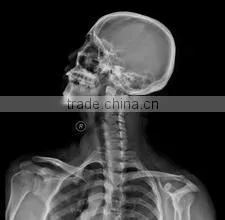Dry Medical Thermal Dry Film KX410 X-ray Film Dry Film thumbnail-5