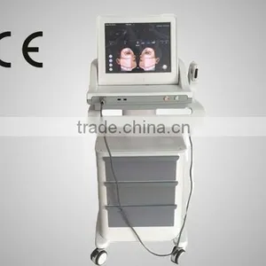 HIFU Machine 2016 Newest High Intensity Deep Wrinkle Removal Focused Ultrasound HIFU With Best Results Nasolabial Folds Removal thumbnail-2