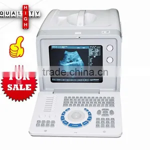CE Medical Device Portable Hospital Clinic Ultrasound Medical Diagnose Scanner/Machine With Probe Transducer-Shelly thumbnail-1