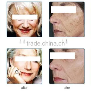 Pdt Led Photodynamic Therapy Pdt Collagen Led Light Therapy thumbnail-5