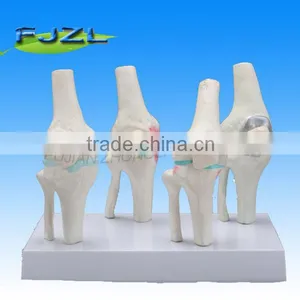 Knee Joints Synthesis Model thumbnail-1