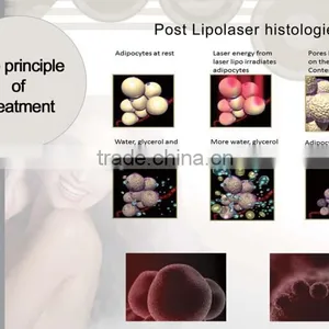 Lipolaser Slimming Machine thumbnail-3
